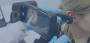 Microsuction ear wax removal using Tympa device